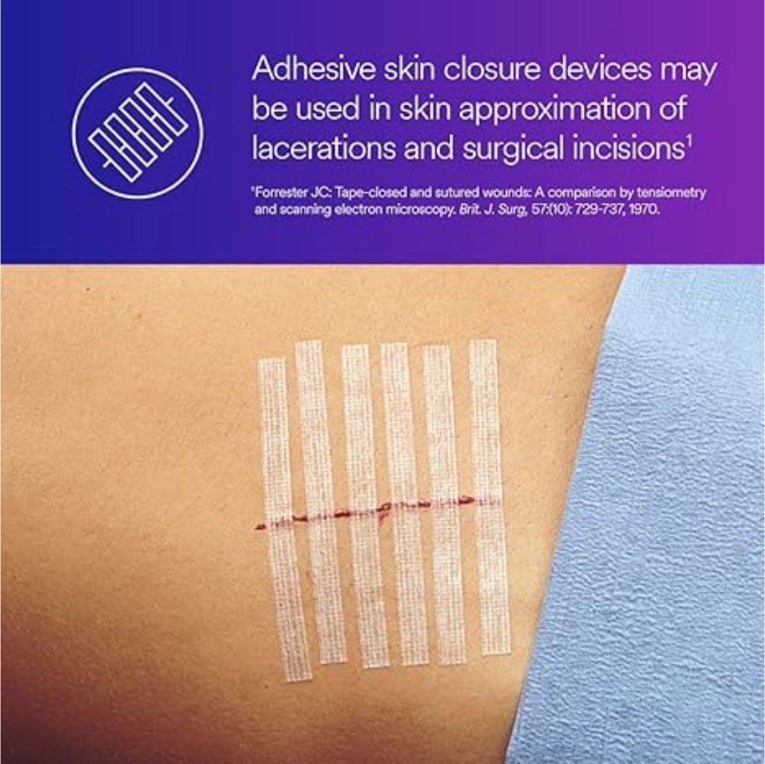 3M Steri-Strip Wound Closure R1547, 12mm x 100mm