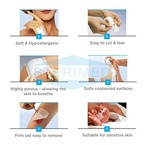 Buy Steripore Surgical Paper Tape Online | Sterimed