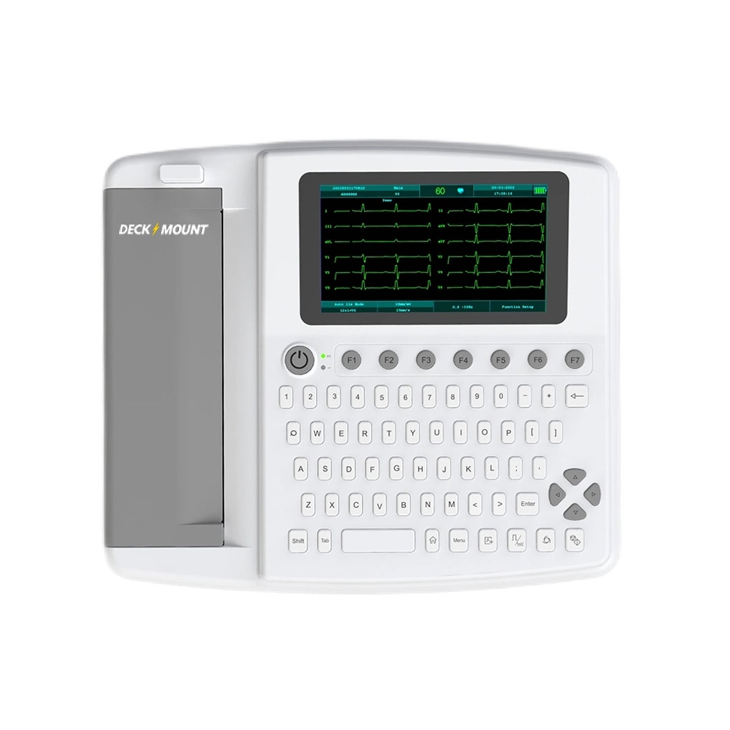 ECG 12 Leads