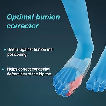 Tynor Bunion Splint - Universal ( K-14 )