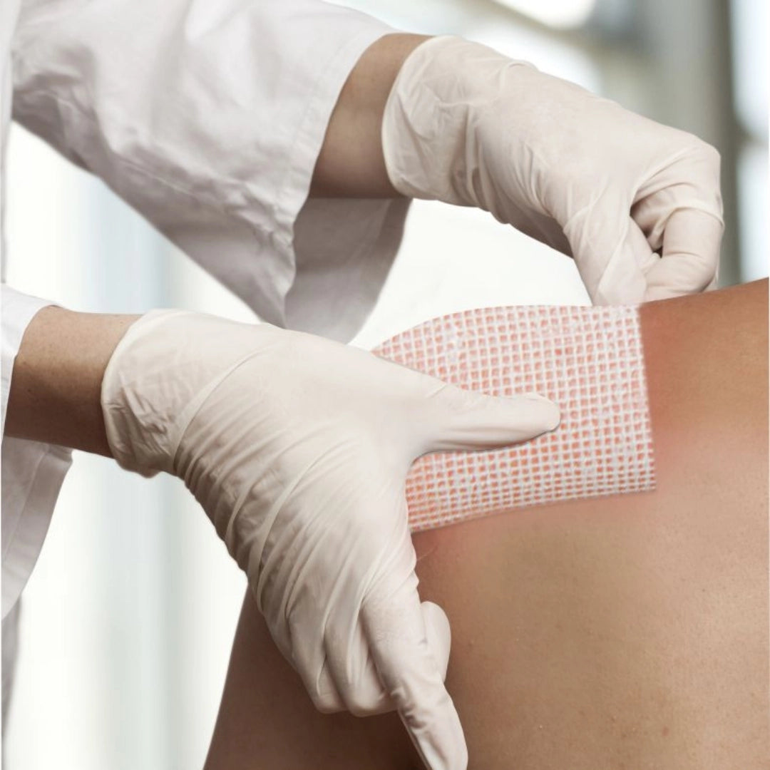 Buy Chlorhexidine Gauze Dressing -10 x 10 - 30 Packs Online