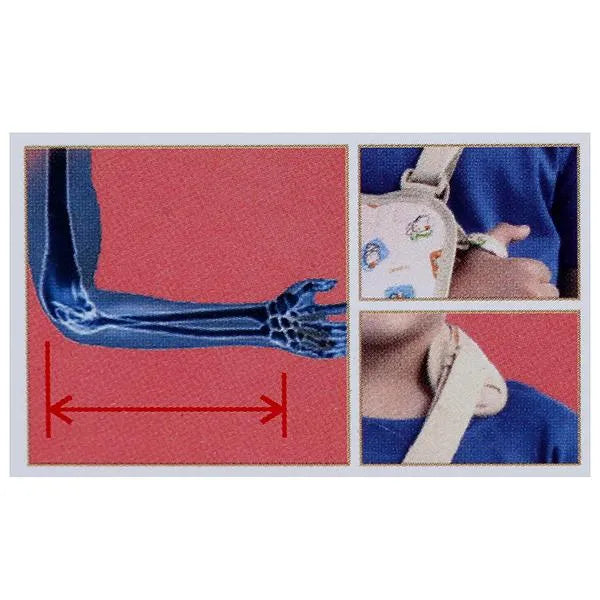 Pediatric Arm Sling Online: Medium Size Available - Flamingo