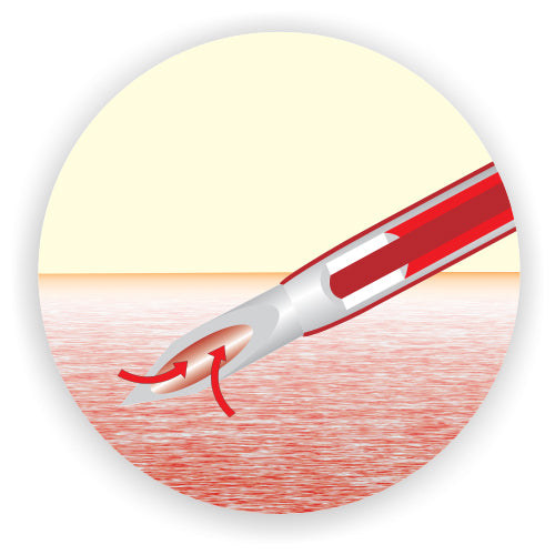 Polymed Nouvo Safety Set