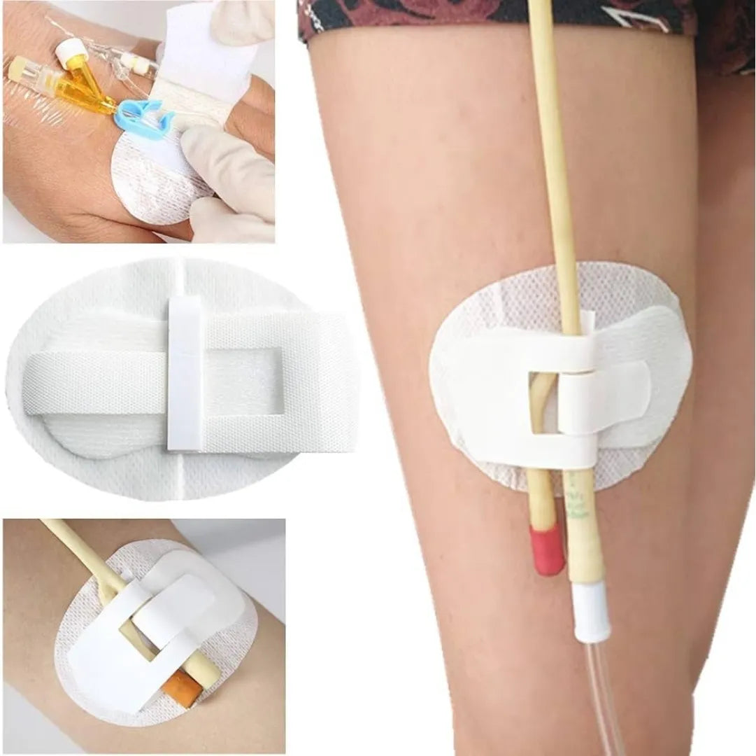 Buy Foley Fixation Dressing with Fixocath and Statlock