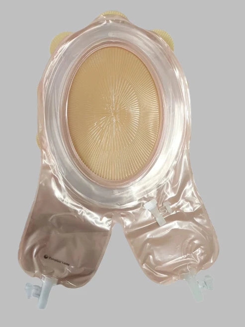 Coloplast Fistula and Wound Management System ( 14060 )