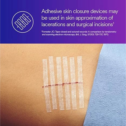 3M Steri-Strip Wound Closure R1547, 12mm x 100mm