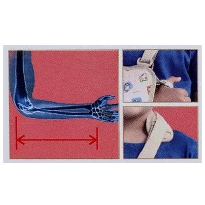 Pediatric Arm Sling Online: Small Size Available - Flamingo