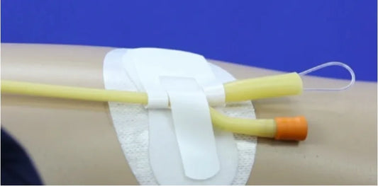 Buy Foley Fixation Dressing with Fixocath and Statlock