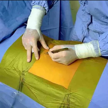 Buy Film Large IO-Drape Online for Surgical Procedures